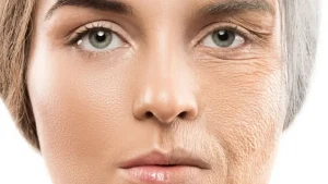 عوامل موثر بر پیری زودرس پوست