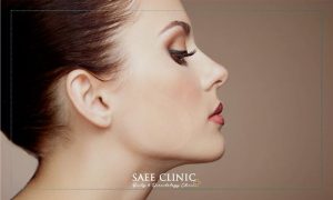 انواع روش های زاوسه سازی صورت