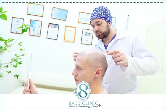 طراحی حرفه ای خط رویش مو در کلینیک ساعی