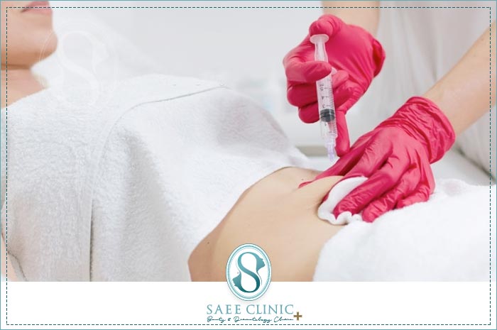 مرحله برداشت چربی از شکم