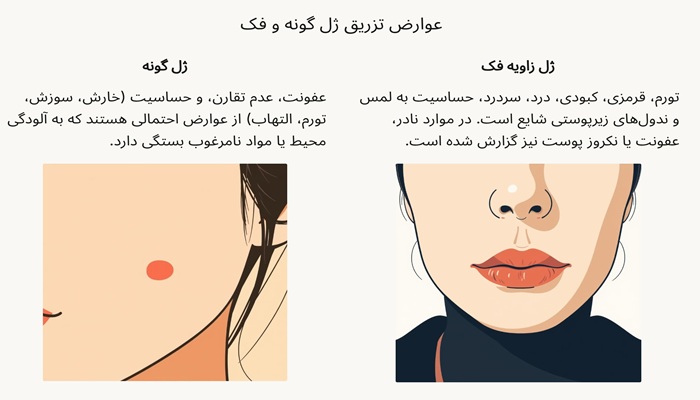 عوارض تزریق ژل به گونه و فک