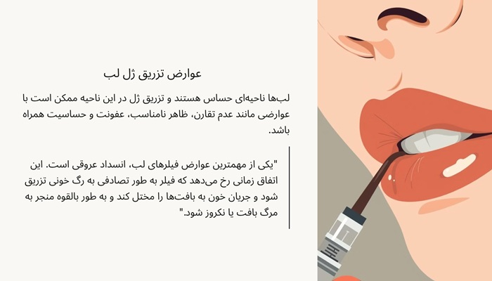 عوارض تزریق ژل در نواحی مختلف