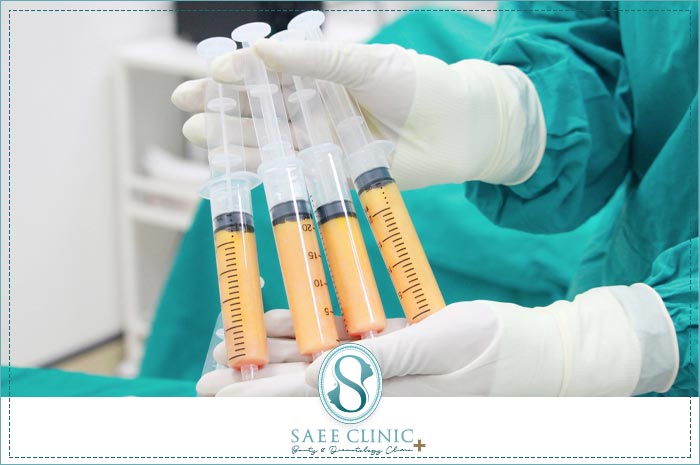 تهیه چربی استخراج شده از بدن