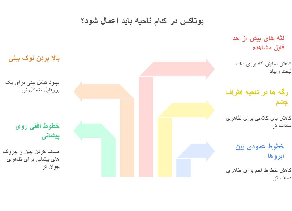 بوتاکس در کدام نواحی بیشتر اعمال می شود؟