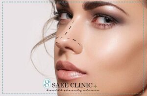 فرم دهی بینی بدون نیاز به جراحی