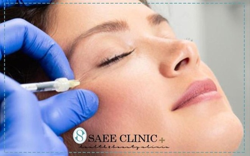 تزریق ژل زیر چشم چگونه انجام می‌شود؟