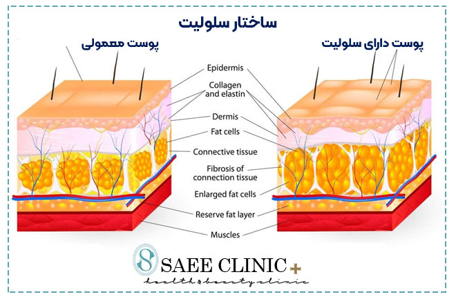 ساختار سلولیت