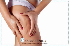 لاغری با دستگاه اگزیمیا