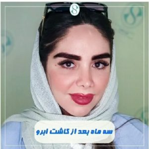 کاشت ابرو دائمی