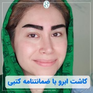 نمونه کار کاشت ابرو