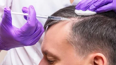 مزوتراپی و PRP تراپی، دو روش درمانی برای داشتن موهای زیبا