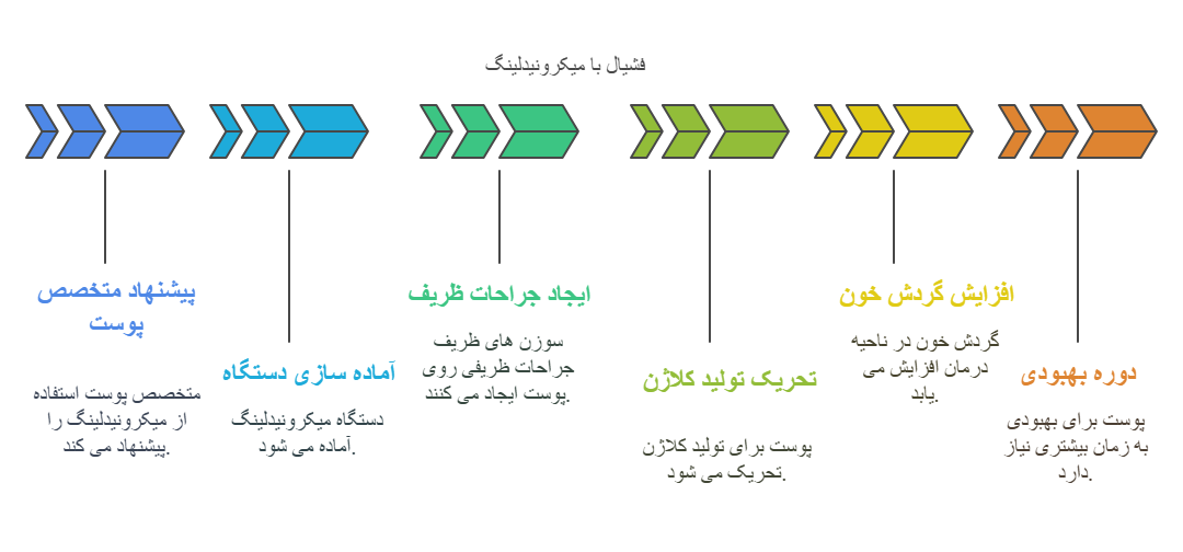فشیال با میکرونیدلینگ