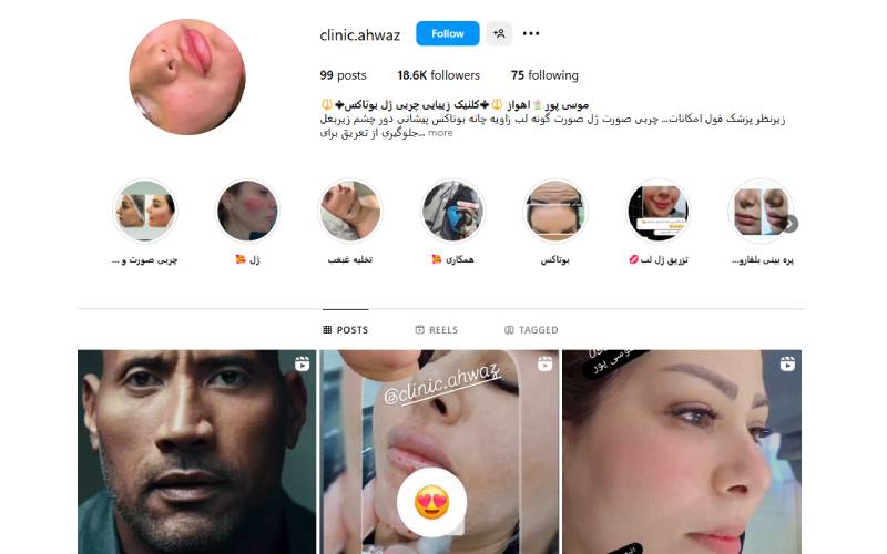 کلینیک کاشت موی سبز