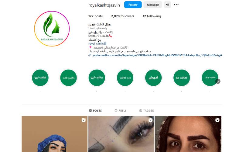 رویال کاشت قزوین‎