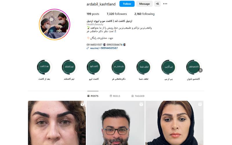 کلینیک اردبیل کاشت لند