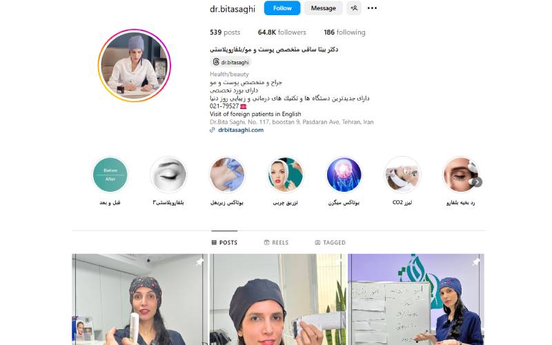 کلینیک بلفاروپلاستی دکتر بیتا ساقی