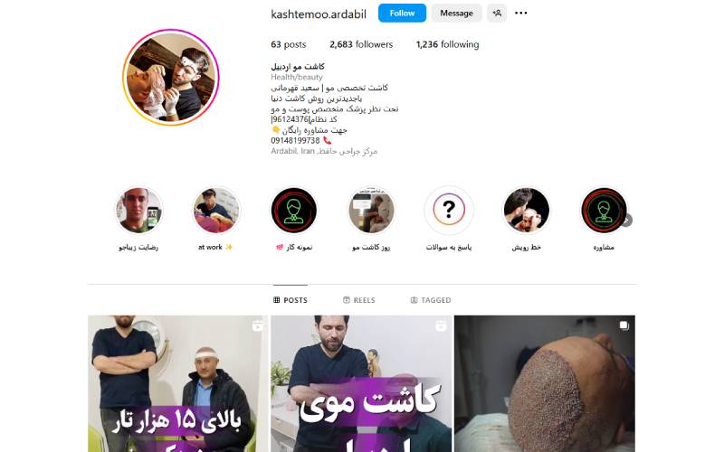 کلینیک کاشت مو سعید قهرمانی