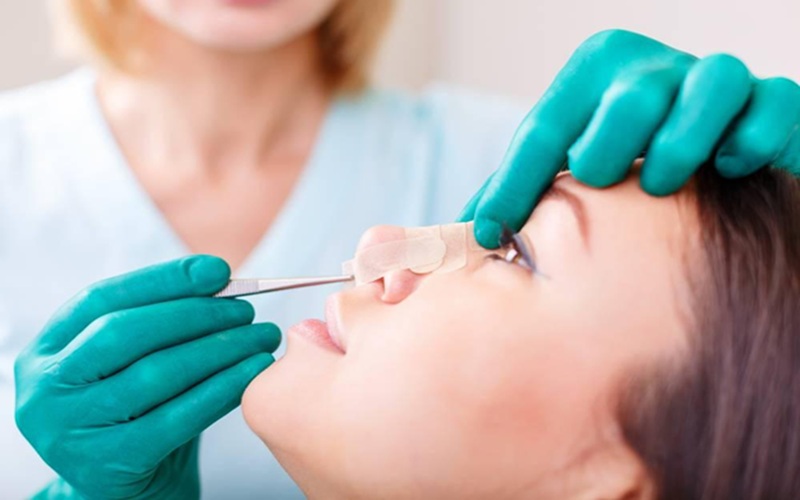 بهترین نحوه خوابیدن پس‌از عمل بینی چگونه است؟