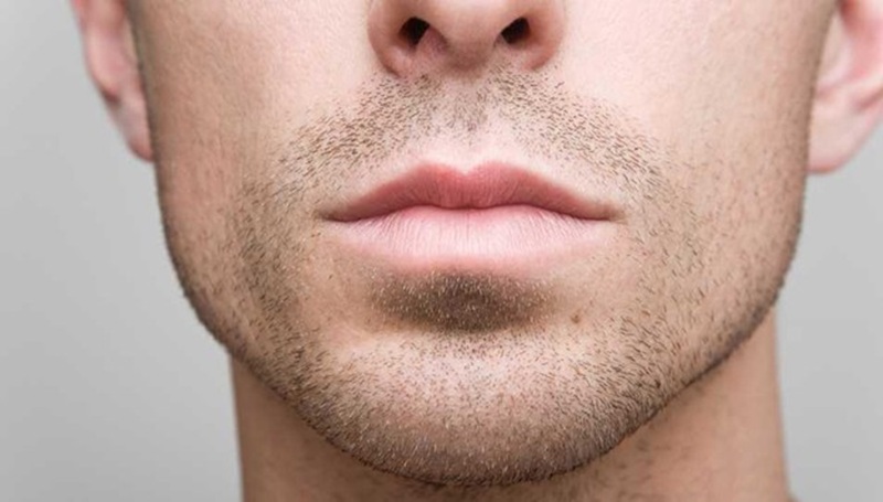 زاویه فک چیست و چرا اهمیت دارد؟