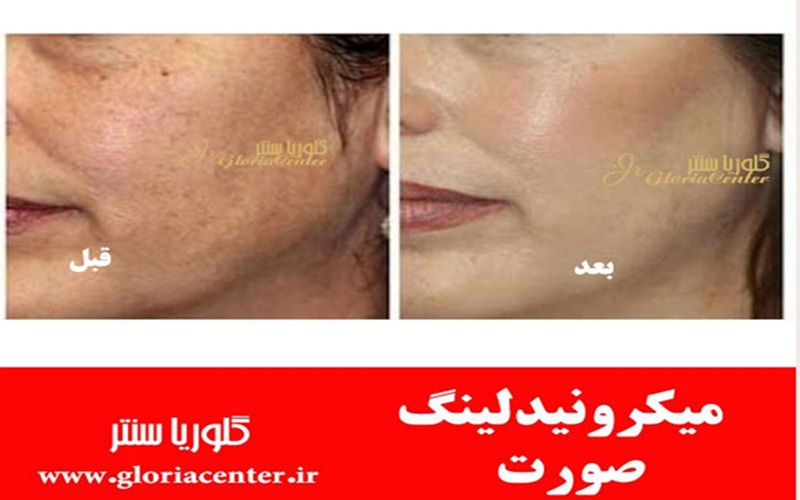 کلینیک گلوریا سنتر