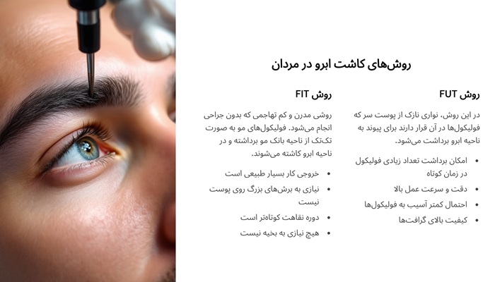 روش های کاشت ابرومردانه
