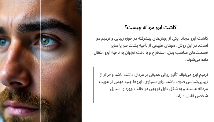 کاشت ابرو مردانه