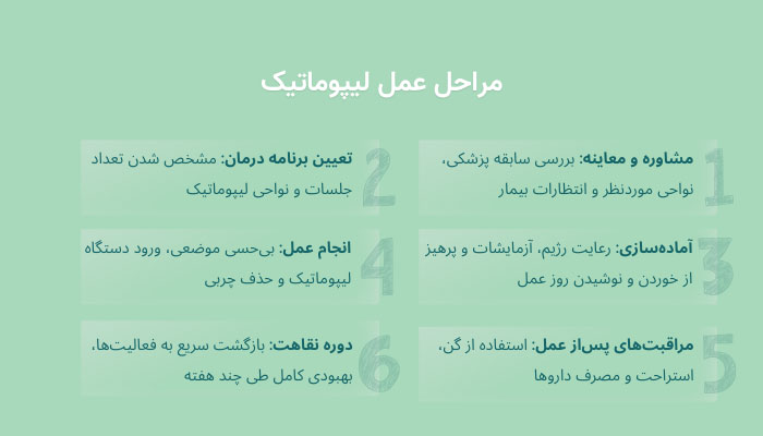 مراحل انجام عمل لیپوماتیک