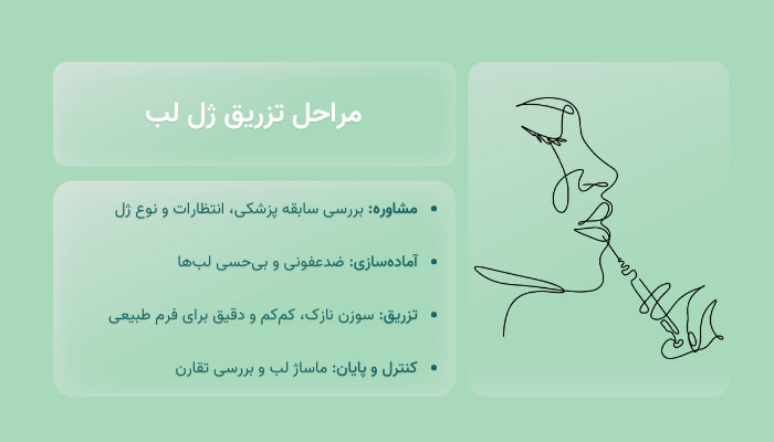 مراحل تزریق ژل لب