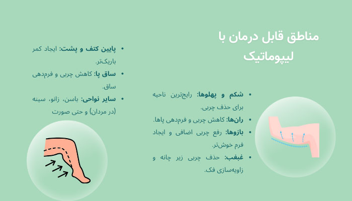 مناطق قابل‌درمان با لیپوماتیک